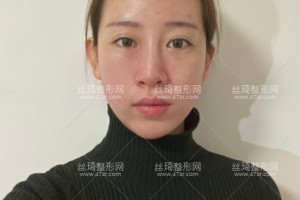 成都軍大美容整形醫(yī)院口口碑好嗎？附醫(yī)院介紹+祛斑果